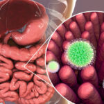 Diarrea aguda y crónica